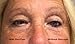 Diva Eyes, Tightens, Lifts& Repairs Areas Around The Eyes, with Cucumber Extract, Hyaluronic Acid, Aloe and Fission Instant Lift By Diva Stuff