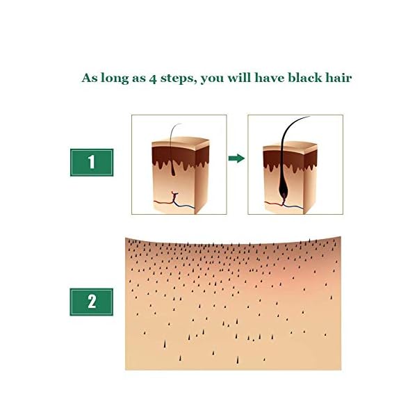 Ginger Germinal Oil, Hair Growth Oil, Hair Growth Serum, Ginger Germinal Essential Oil, Hair Loss Treatment Hair Care…