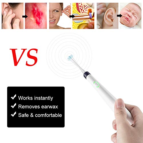 Ear Wax Removal Kit, Ear Cleaner, Electric Earwax Removal Tools, Ear Vacuum Cleaner, Soft Silicone,4 Types Ear Spoons, with LED Light Powerful Suction, Safe & Comfortable for Adults/Kids