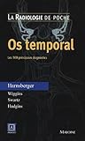 Image de Os temporal (French Edition)