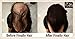 Hair Building Fibers Dark Grey 25 Grams Refill Your Existing Bottle. Highest Grade Fiber by Finally Hair (Dark Gray)
