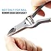 IBEET Nail Clippers Set Fingernail and Toenail Clipper Cutter Set, Sturdy Stainless Steel Water Resistant Nail Clipper