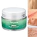 Tetyana naturals Scar Removal Cream Advanced Treatment for Old & New Scars from Cuts Stretch Marks C-Sections & Surgeries With Natural Herbal Extracts Formula （hypoallergenic）