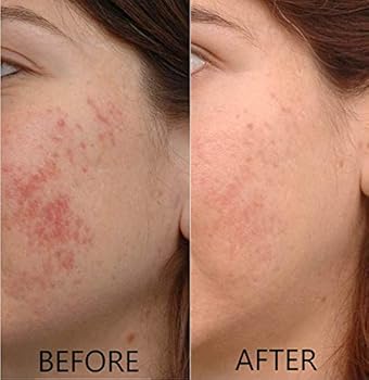 dr brenner vitamin c serum