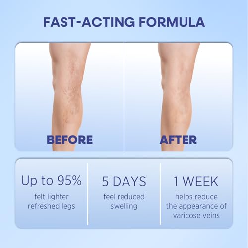 Hermon Varicose Veins Cream, Varicose Veins for Legs, Spider Vein for Legs, Natural Soothing Leg Varicose & Spider Veins Cream - 5.07 Fl Oz
