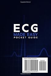 ECG Made Easy Pocket Guide: An Indispensable Guide