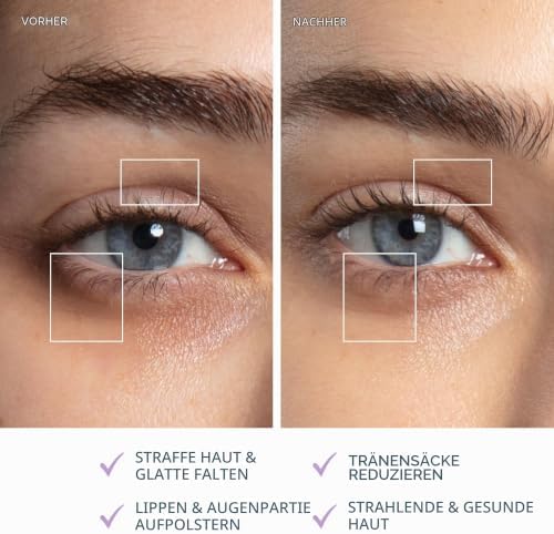 BEAR 2 Eyes & Lips - Massagegerät gegen Falten für sofortige Gesichtsstraffung - Augenmassagegerät - Augenbrauenlifting - Behandlung gegen Augenringe & Lippenpflege - Lavender