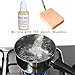 Desolakly Squeeze Acne Toys Pimple Popping Set Kit Funny Toy Popper Remover Stop Picking Zit Tool