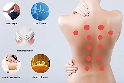 Anti Cellulite Vacuum Cup Sets (7 cups) By SBDX,Vacuum Cupping Therapy Cups Anti-aging, Wrinkle Reducer, Myofascial Release(Blue)