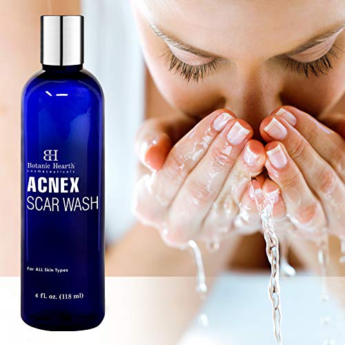 BOTANIC HEARTH Acnex Scar and Acne Wash - Facial Cleanser for Acne, Blemishes & Dark Spots - Helps Clear Pores, Reduce appearances of Acne Scars and Promotes Glowing Skin, 4 fl oz