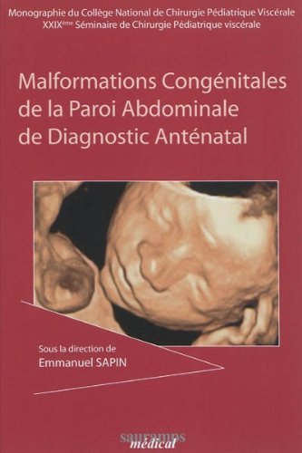Malformations congénitales de la paroi abdominale et diagnostic anténatal