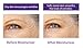 Trilane Anti-Aging Rejuvenating Eye Cream, 0.5 fl. oz