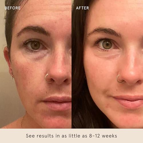 Barefaced Overachiever 1 Fl Oz – 10-in-1 Skin Booster with Bakuchiol, Resveratrol & Green Tea – Retinol Alternative, Hydrates, Minimizes Pores & Fine Lines