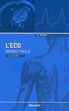 Image de L'ECG rendu facile (French Edition)
