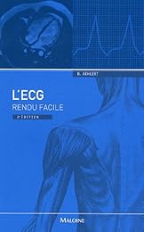 L' ECG rendu facile