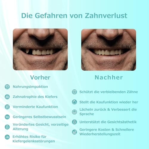 Custom Partial Dental Denture - Temporary Denture, Removable and Temporary Denture. Perfect fit and easy to use to recreate your smile at home (1 tooth)