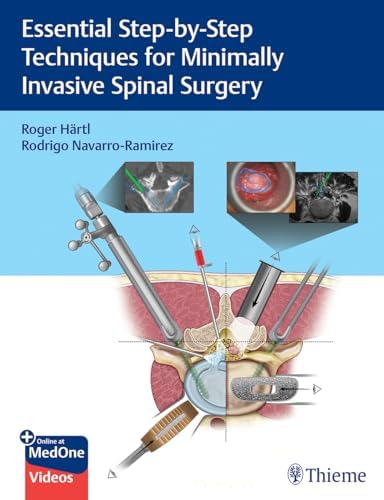 Spine Surgery: Tricks of the Trade: 9781604068962: Medicine