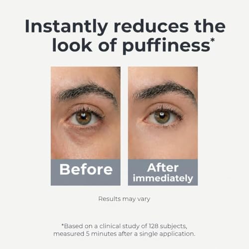 Under Eye Brightener Roller - Caffeine & Retinol Eye Serum for Dark Circles, Puffiness & Fine Lines, Travel Essential Vegan Skincare, Cooling Eye Massage, Dermatologist-Tested, 0.52 fl oz