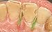 Zubastick Dental Transparent Sectional Contoured Matrices Matrix 300 pcs