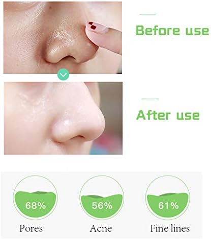 greenlouch pore corset