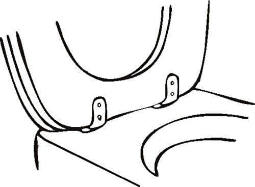 CORNAT TEC364980 Toilet seat Hinge Soft Close with Mounting Brass, Weiß - Image 5