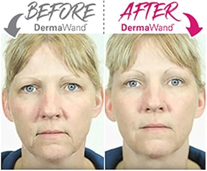 dermawand best price