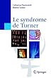 Syndrome de Turner Oubvrage