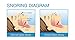 Premium Anti-Snoring Chin Strap - Stop Snoring Anti Snore Sleep Aid Device - Fully Adjustable Jaw Strap - Natural Comfort for CPAP and Instant Snore Relief by SleepPro™ [UPGRADED VERSION]