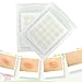 Acne Stickers,Acne Master Pimple Patch-Spot Repair Patches Absorbing Cover 60 Count,Spot Repair Patches,Against Pimples,Spots,Blemishes and Blackheads Stickers