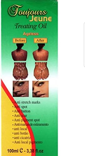 Skin treating oil, anti-blemish, anti-button, anti-spot, anti-scar, anti-strech marks