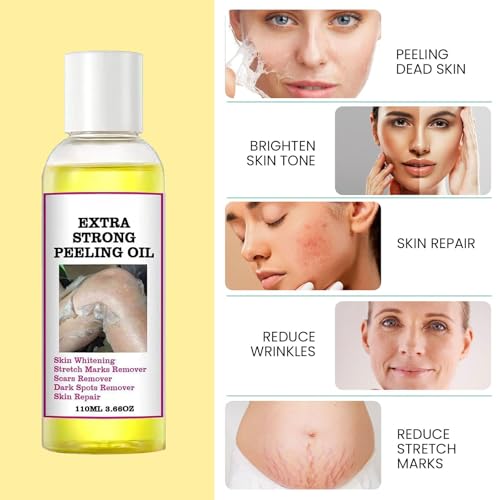 LBOYLOVE® 2 Pcs Yellow Peeling Oil, Extra Strong Peel Oil for Dark Skin with Camellia Leaf, Licorice Root and Chamomile Extract for Body Hand Foot, for All Skin Types