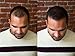Hair Building Fibers for Balding Hair (22g / Large Bottle) - Instant Hair Thickening Fibers for Thinning Hair - Discreetly Cover Bald Spots by grace and stella (Blond)
