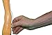 Pfaff Nature Pet Premium Carpal Splint/Carpal Joint Bandage for Dogs (Large)