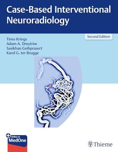 健康・医学 Decision Making in Neurovascular Disease Decision Making in Neurovascular Disease: 9781684200573: Medicine