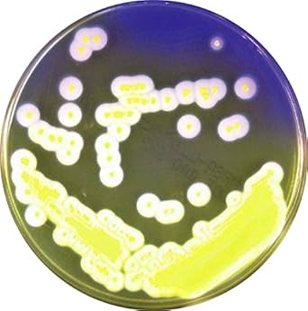 Amazon 日水製薬 生培地 ニッスイプレート 変法卵黄加マンニット食塩寒天培地ex 10枚 寒天培地 産業 研究開発用品 通販