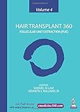 Hair Transplant 360: Follicular Unit Extraction (FUE)