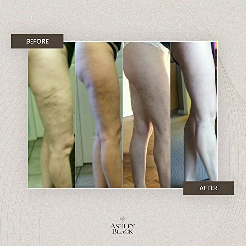 FasciaBlaster Mini 2 by Ashley Black Cellulite Massager Tool Deep