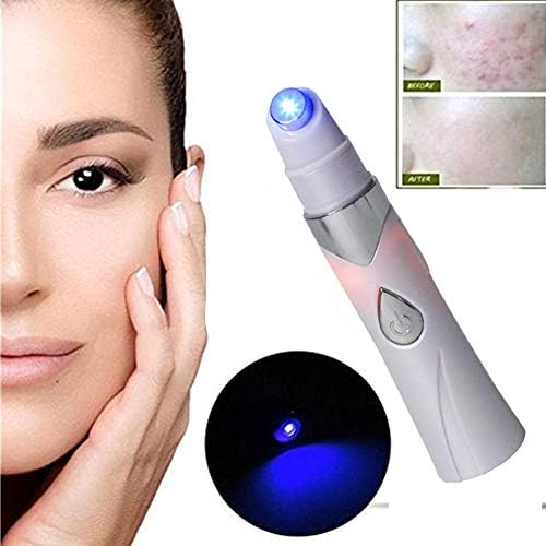 Spider Vein Eraser - The Powerful Anti-Varicose Veins, Remove Anti-Varicose Face Acne Removal Pen