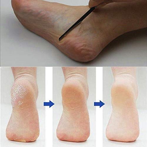 image for acction Women Pedicure/Manicure Nail Cleaner Cuticle Grooming Dead Ski