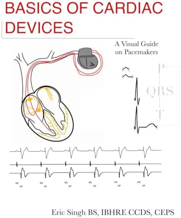 The EHRA Book of Pacemaker, ICD, and CRT Troubleshooting: Case