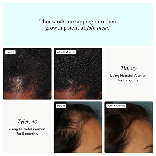 Nutrafol Women's Hair Growth Supplement Ages 1844 Clinically