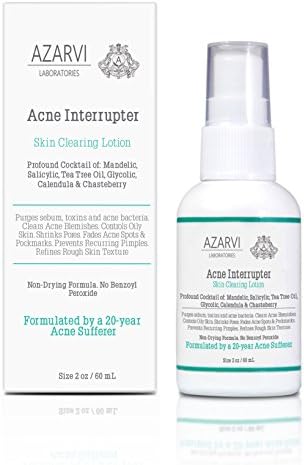 Non-Drying Acne Lotion with Salicylic, Tea Tree, Mandelic and Calendula Oil. Erases Acne, Pimples, Blackheads, Shrinks Pores- Size 2 oz