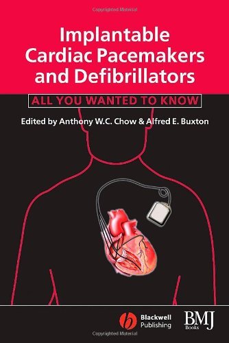 Implantable Cardiac Pacemakers and Defibrillators: All You Wanted to Know