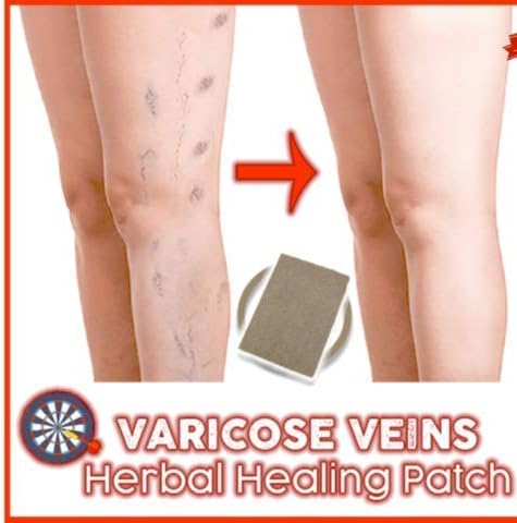 Varicose Veins Herbal Healing Patch 6PCS/Set
