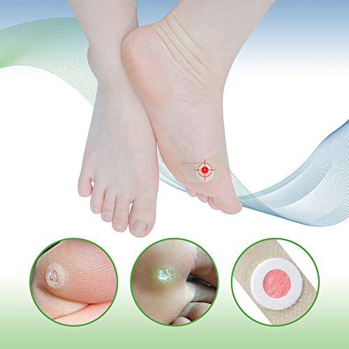 Wart Remover, Corn Remover Pads, Foot Corn Removal Plaster with Hole, Professional Removes Common and Plantar Warts, Callus, Stops Wart Regrowth 24Pcs