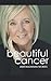 Beautiful Cancer: How to Embrace One of Life's Greatest Challenges, Defining a Beautiful Approach to by Jami Buchanan McNees