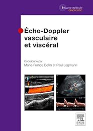 Écho-Doppler vasculaire et viscéral