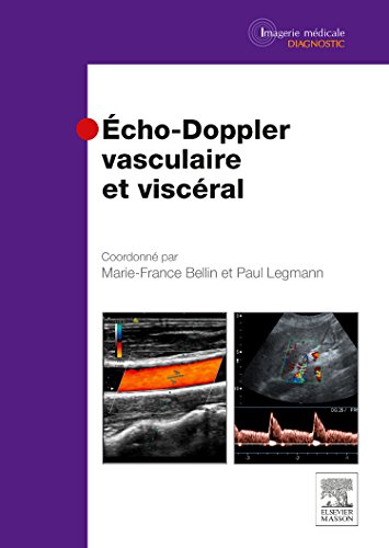 Écho-Doppler vasculaire et viscéral