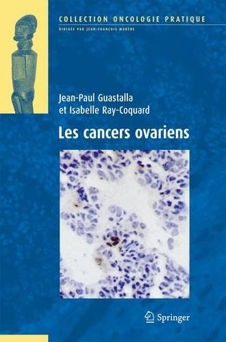 Les  cancers ovariens