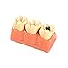 Easyinsmile 4 Times New Dental teeth model Patient Education Model Caries Disassembling tooth model